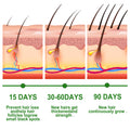 Rosemary Oil For Hair